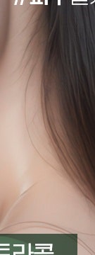 꺼진 볼부터 눈 밑까지, 용산 울트라콜 적용 부위 사진 19