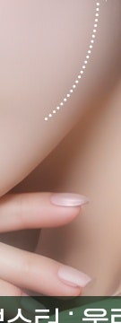 꺼진 볼부터 눈 밑까지, 용산 울트라콜 적용 부위 사진 18