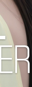 꺼진 볼부터 눈 밑까지, 용산 울트라콜 적용 부위 사진 28
