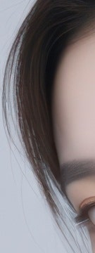 꺼진 볼부터 눈 밑까지, 용산 울트라콜 적용 부위 사진 7