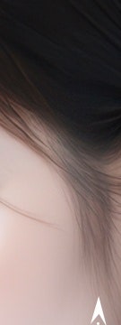 꺼진 볼부터 눈 밑까지, 용산 울트라콜 적용 부위 사진 10