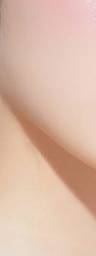 피부 속부터 달라지는 변화, 반포역 줄기세포 사진 18