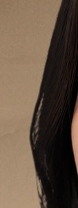 반포동 색소 치료, 더 진해지기 전에 확인하세요. 사진 18