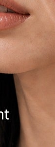 반포동 색소 치료, 더 진해지기 전에 확인하세요. 사진 28
