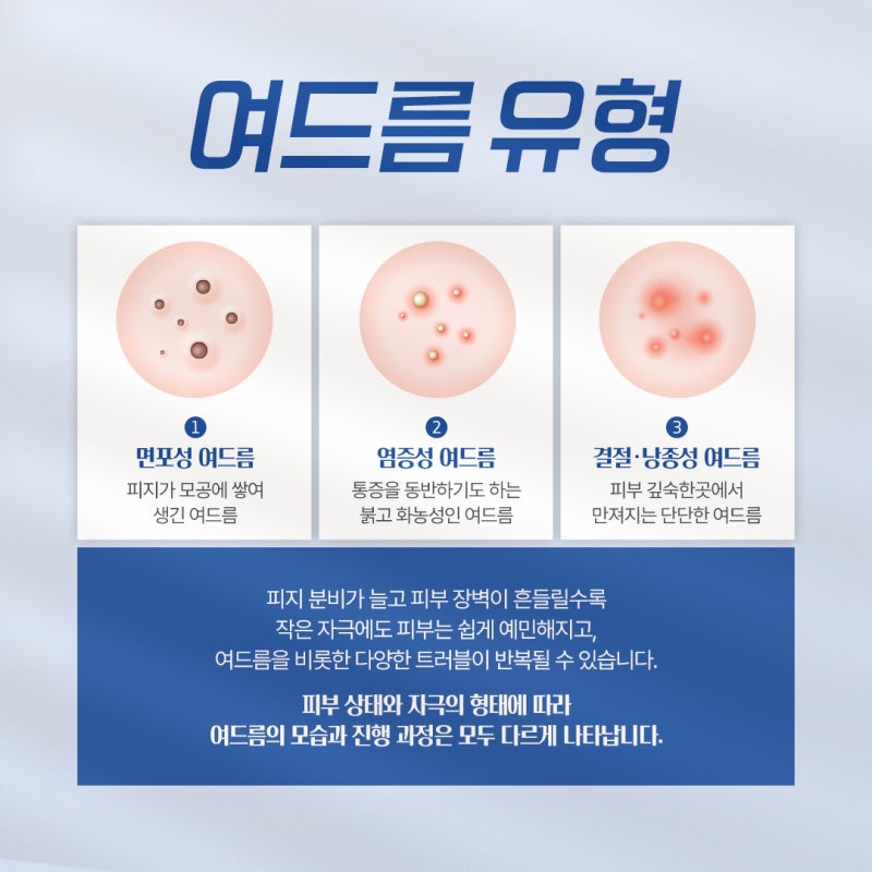 방배 여드름 프로그램, 부위별 원인부터 확인해야 되는 이유 사진 4