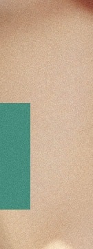 용산 스컬트라 병원 선택 전 알아볼 것, 볼·팔자 효과와 가격 사진 27