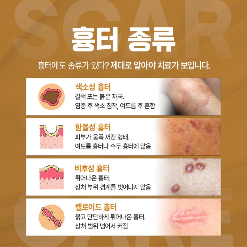 옅어졌던 흉터가 다시 진해진다면? 고속터미널역 피부과 상담 팁 사진 4