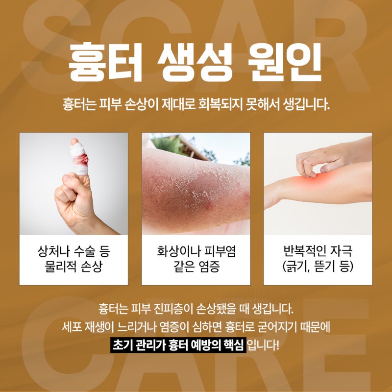 옅어졌던 흉터가 다시 진해진다면? 고속터미널역 피부과 상담 팁