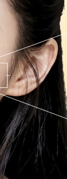 고속터미널역 줄기세포, 시술 전 꼭 확인해야 할 4가지 총정리! 사진 20