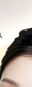 고속터미널역 줄기세포, 시술 전 꼭 확인해야 할 4가지 총정리! 사진 10