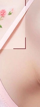 방배 문신제거 시작 전 흔히 놓치는 3가지 사진 26