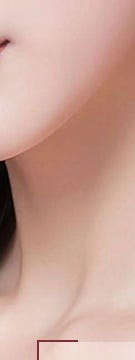 방배 문신제거 시작 전 흔히 놓치는 3가지 사진 17