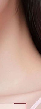 방배 문신제거 시작 전 흔히 놓치는 3가지 사진 18