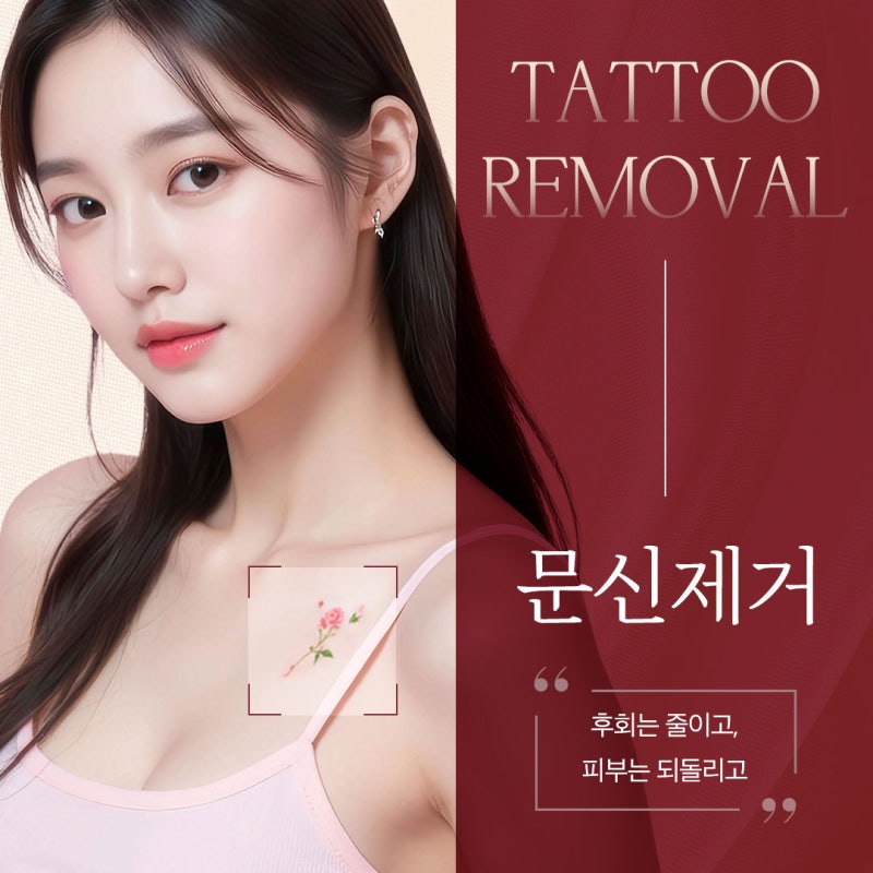 방배 문신제거 시작 전 흔히 놓치는 3가지 사진 2