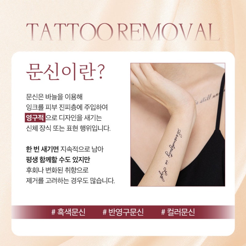 방배 문신제거 시작 전 흔히 놓치는 3가지