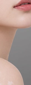 서초 백반증, 흰 반점이 보인다면 먼저 확인해야 할 것들 사진 17