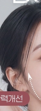 용산 울트라콜, 필러와 다른 점부터 알아야 하는 이유 사진 17