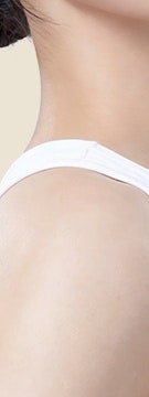 고속터미널역 스컬트라, 꺼진 볼과 처진 라인 고민이라면 사진 25