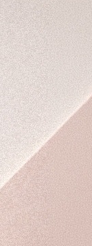 반포 고우리 스킨부스터, 필러 대신 선택하는 이유 사진 13