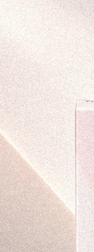 반포 고우리 스킨부스터, 필러 대신 선택하는 이유 사진 9